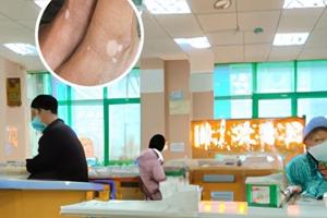 苗医草本乳膏作用与用途