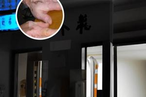 复方氨肽素片的副作用大吗